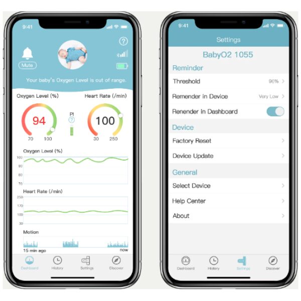 Baby O2 Saturation Monitor – Redmark