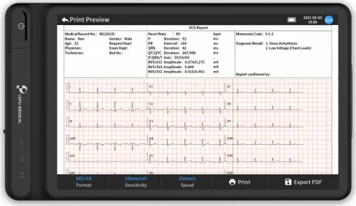 Neo ECG T180 WIFI Enabled - 10 Inch ECG Tablet - Image 6