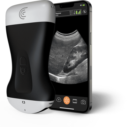 Clarius Portable Ultrasound Scanner