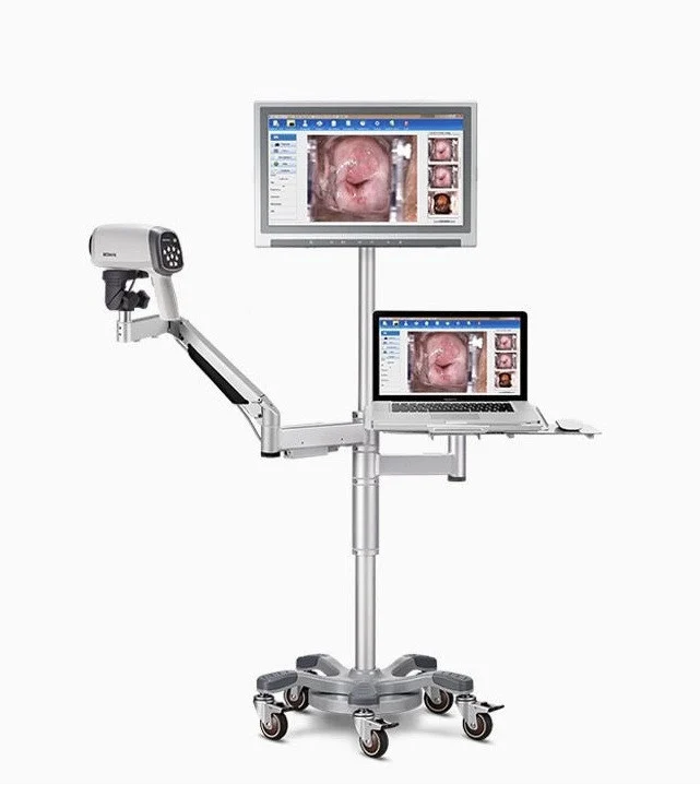 Edan C6A HD Colposcope with PC Workstation