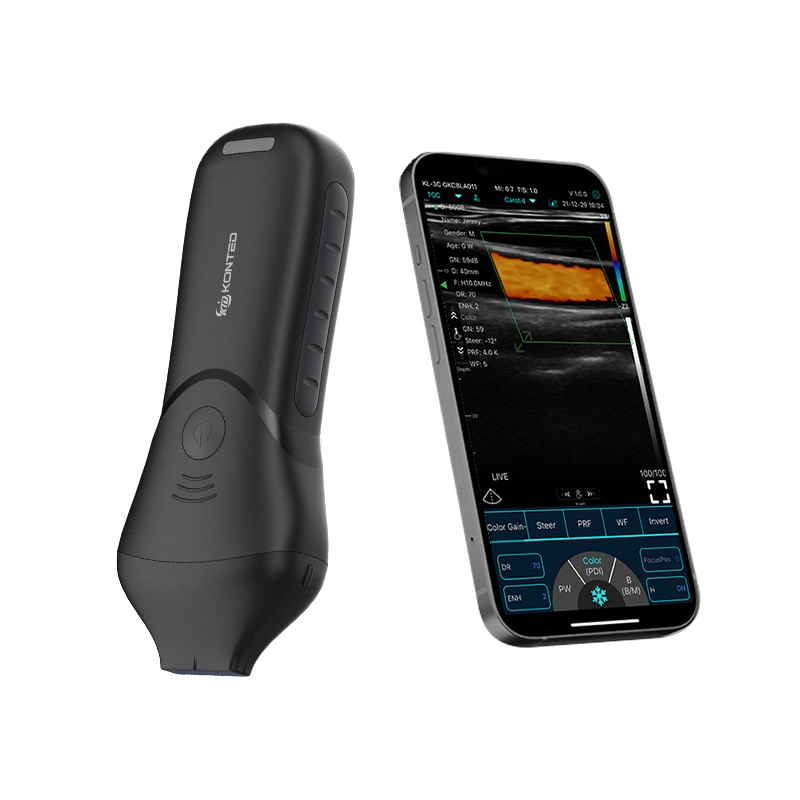 C10MB Pro – Aesthetic & Nerve Precision Ultrasound Probe - Image 4