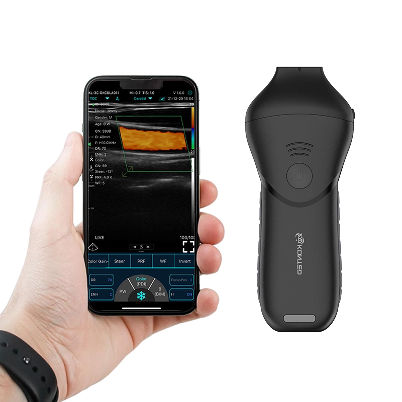 C10MB Pro – Aesthetic & Nerve Precision Ultrasound Probe - Image 3